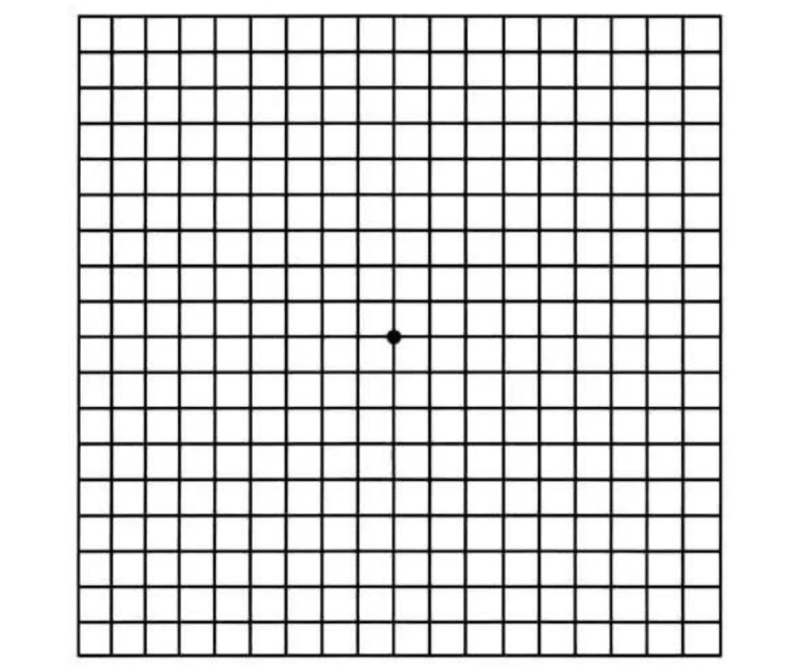 Amsler grid as seen with normal vision.