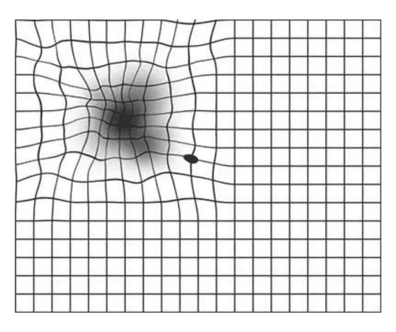 Amsler grid as seen with person with AMD. Test for seeing vertical lines in vision.